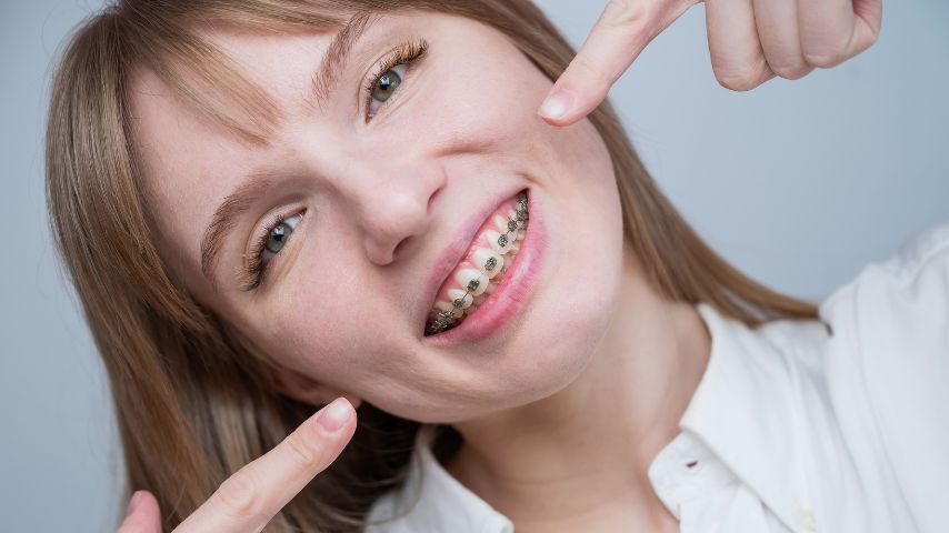 Dieta z aparatem ortodontycznym pomaga zachować zdrowe zęby. Na zdjęciu młoda kobieta z aparatem na zębach chwali się efektami.